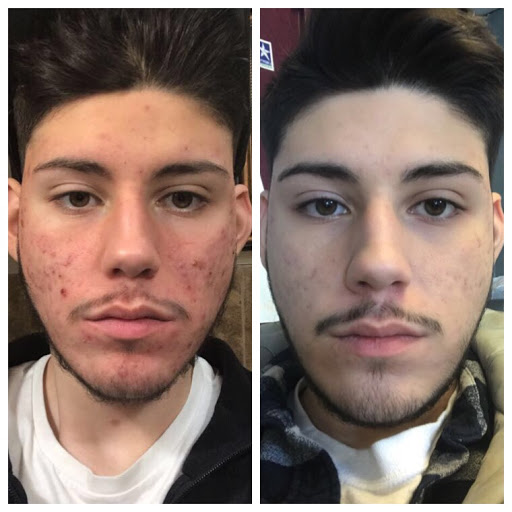 Medical Spa «Joules Medspa and Laser Center», reviews and photos, 14840 Granada Ave, Apple Valley, MN 55124, USA