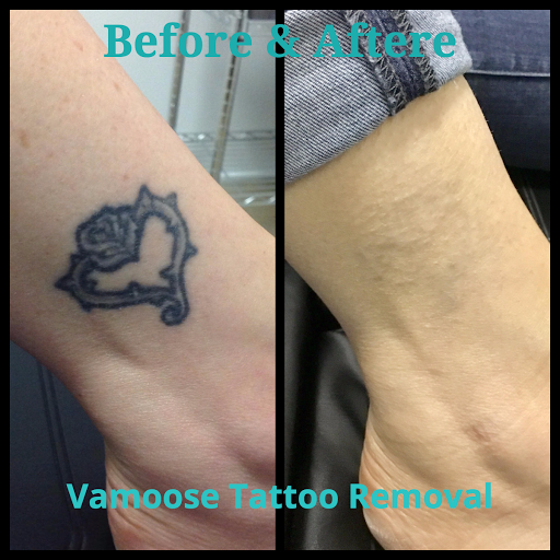 Explore tattoo ideas to cover up a name, creative tattoo ideas in Milwaukee, available at Removery Tattoo Removal & Fading
