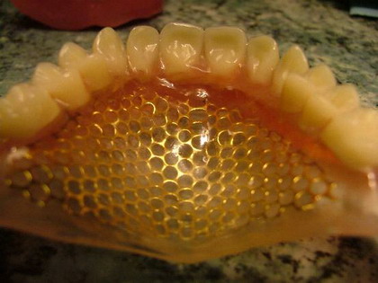 Hozzászólások és értékelések az Vitál-Lux-Dental Fogtechnika - fogtechnikus, rugalmas fogsor, allergiamentes fogsor, bio fogsor-ról