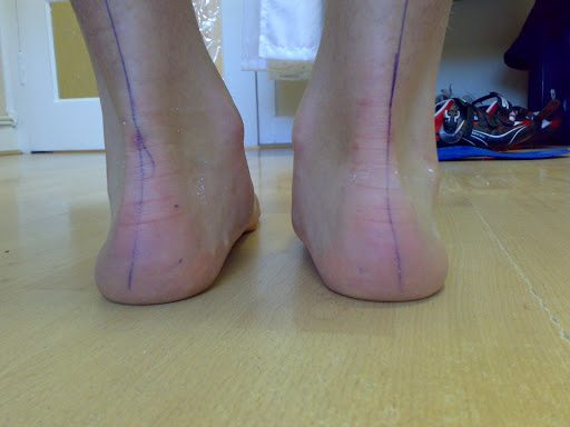 Joe Kelly Old Bawn Podiatry in Dublin 24, Co. Dublin (Baile Átha Cliath)