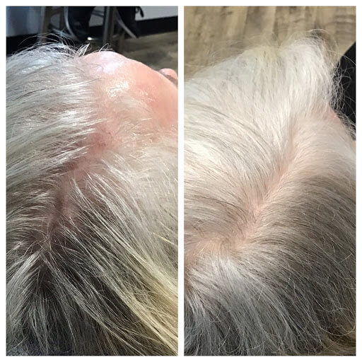 Explore slytherin tattoo ideas, creative tattoo ideas in Portland, available at Oregon Medical & Laser (formerly Cascade Medical & Tattoo Removal)