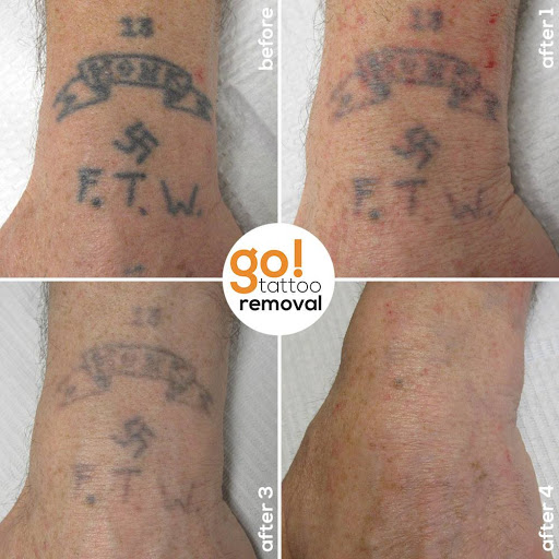 Explore buzz lightyear tattoo ideas, creative tattoo ideas in Allentown, available at Removery Tattoo Removal & Fading