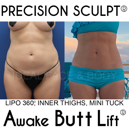 Ideal Face & Body image