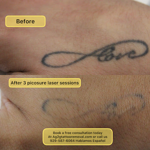 Explore tattoo flash sheet ideas, creative tattoo ideas in New York, available at Ag2g Laser Tattoo Removal & MedSpa