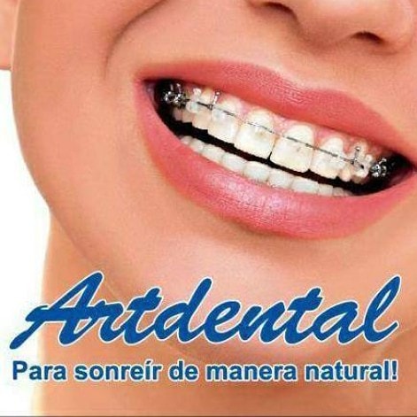 Artdental