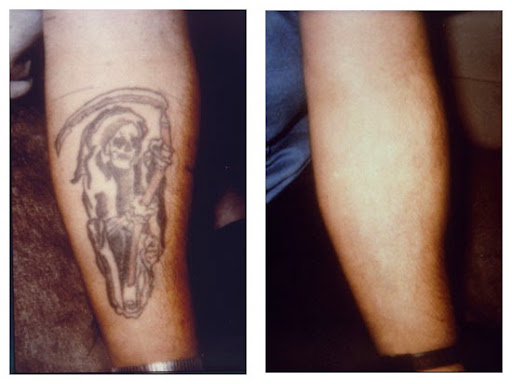 Explore tattoo ideas men, creative tattoo ideas in Colleyville, available at DFW Tattoo Removal