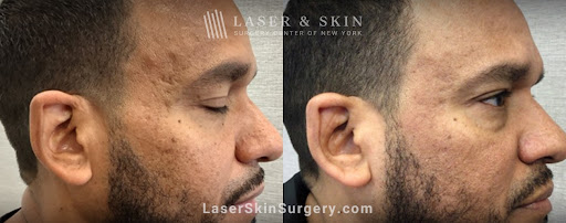 Explore turkish tattoo ideas, creative tattoo ideas in Southampton, available at Laser & Skin Surgery Center of New York - Southampton
