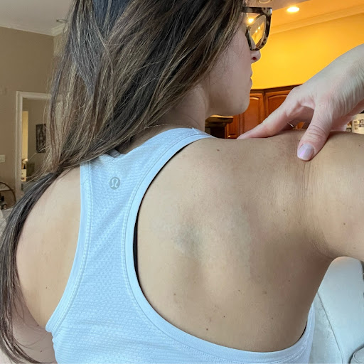 Explore small dragon tattoo ideas, creative tattoo ideas in Rochester, available at Rochester Tattoo Removal