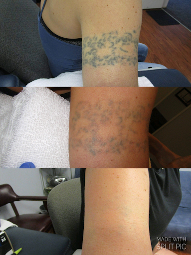 Explore matching cat tattoo ideas, creative tattoo ideas in Houston, available at Houston Tattoo Removal Clinic