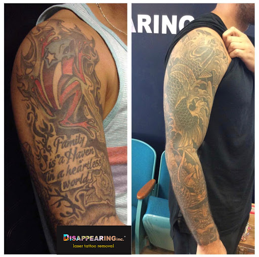 Explore march tattoo ideas, creative tattoo ideas in Lawrence, available at Removery Tattoo Removal & Fading