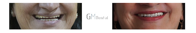 Comentarios y opiniones de Gm dental