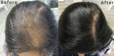 Hair transplantation clinic