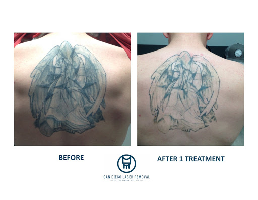 Explore dia de los muertos tattoo ideas, creative tattoo ideas in San Diego, available at Removery Tattoo Removal & Fading