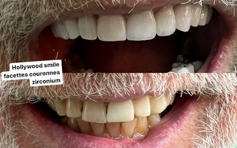 Clinique dentaire Moqadem Hafça Hollywood smile, Implant, prothèse, Facette, Blanchiment urgence dentaire, dentiste Marrakech image