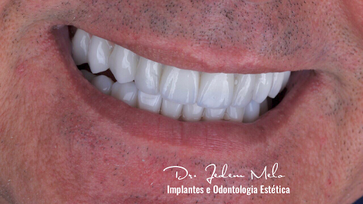 Clínica de implante dentário Manaus