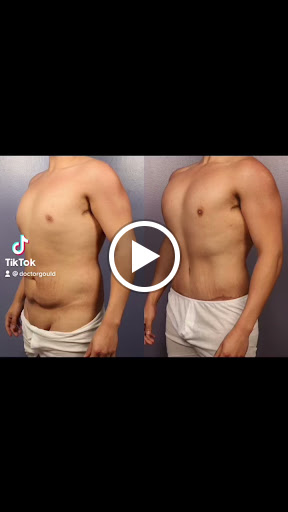 Dr. Gould Plastic Surgery image