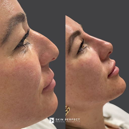 Explore overcome tattoo ideas, creative tattoo ideas in Whittier, available at Skin Perfect Medical Aesthetics