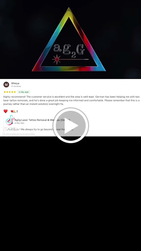 Explore kiss tattoo ideas, creative tattoo ideas in New York, available at Ag2g Laser Tattoo Removal & MedSpa