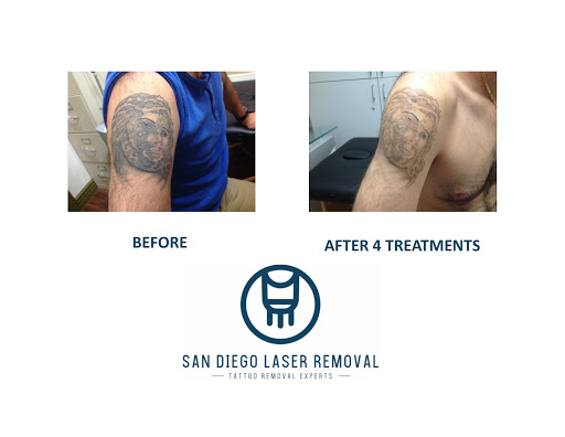 Explore angel memorial tattoo ideas, creative tattoo ideas in San Diego, available at Removery Tattoo Removal & Fading
