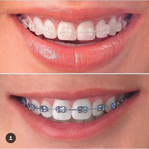 Clínica Dental Odontodent San Bernardo - Dentista