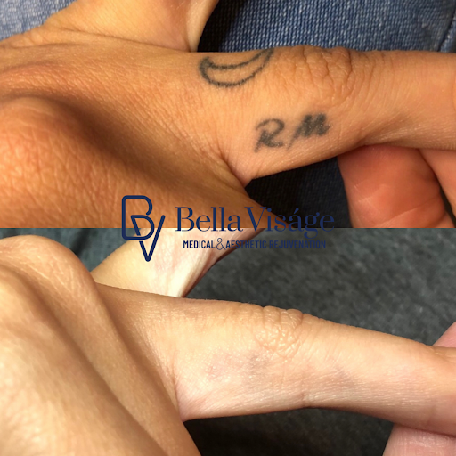 Explore texas flag tattoo ideas, creative tattoo ideas in Lakeland, available at Bella Visge Medical & Aesthetic Rejuvenation