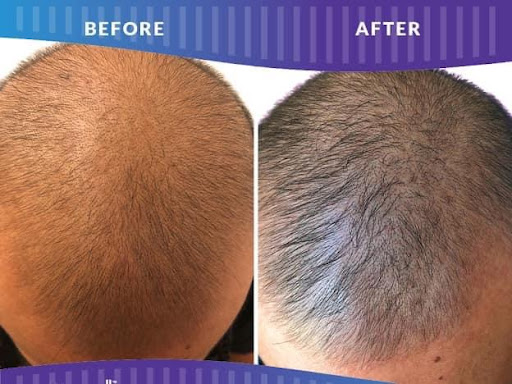 Explore michelangelo tattoo ideas, creative tattoo ideas in Savannah, available at Haute Brows. Cosmetic Tattoo