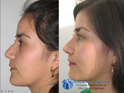 Cirujano Plástico Facial Otorrino en Bogota Dr Alejandro Lastra