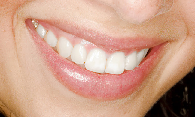 The Teeth Whitening Lab - Christchurch Former Dental Therapist - Dentist