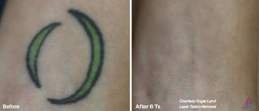 Explore skydiving tattoo ideas, creative tattoo ideas in Fort Myers, available at Laser Tattoo Removal by Tatt Cemetery