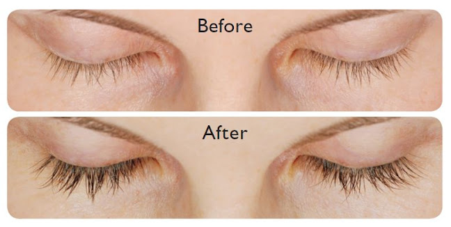 Comments and reviews of Mylash
