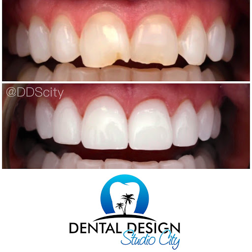 Dental Design Studio City image