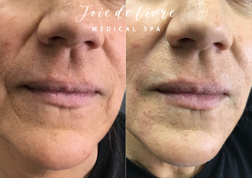 Explore nf tattoos ideas, creative tattoo ideas in Canton, available at JDV Med Spa