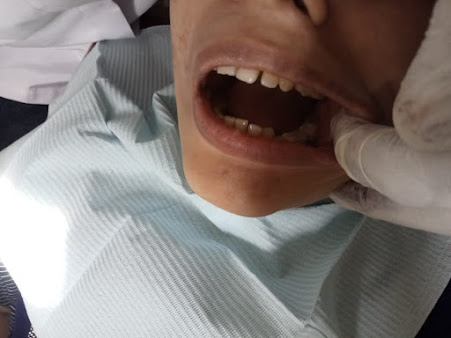 Panama Dental Lab - Panama Dental Lab