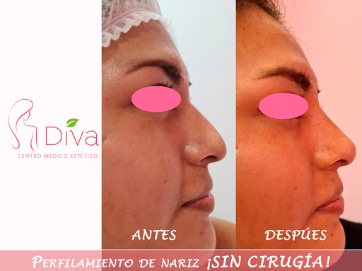 Diva Centro Médico Estético