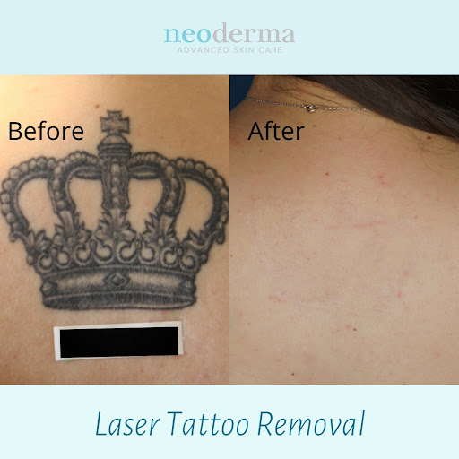 Explore crane tattoo ideas, creative tattoo ideas in Anaheim, available at Neoderma