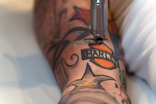 Explore deathly hallows tattoo ideas, creative tattoo ideas in Commack, available at Evolution MedSpa