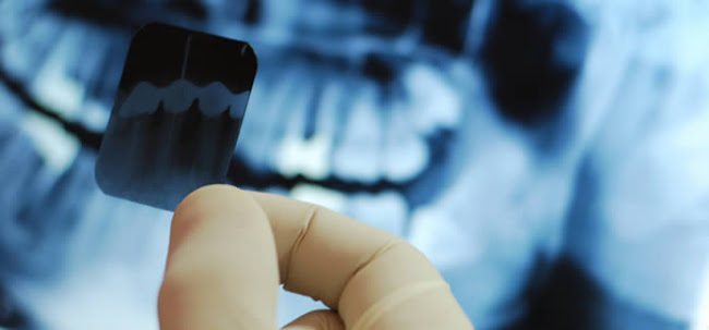 RAYDENT Radiografía Dental - Dentista