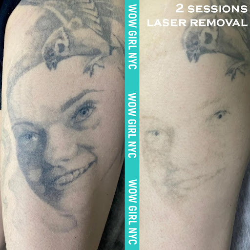 Explore women thigh tattoo ideas, creative tattoo ideas in New York, available at WOW LASER NYC Tattoo removal in New York