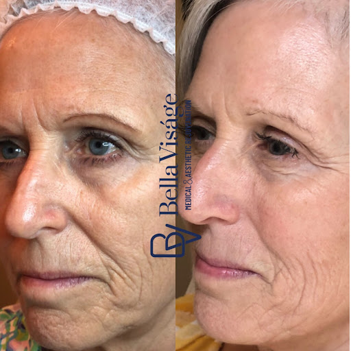 Find tattoo ideas for zodiac signs for your next unique tattoo in Lakeland at Bella Visge Medical & Aesthetic Rejuvenation