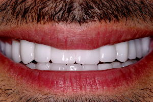 BÜYÜKGEBİZ Diş Polikliniği - BGZ Dental Turkey image