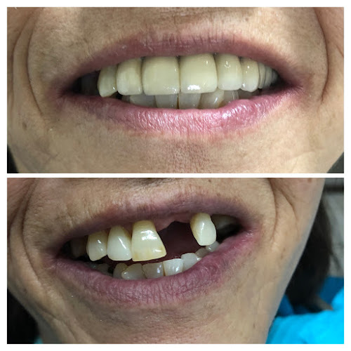 Consulta Dental Full Smile - Dentista