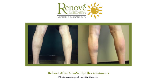 Day Spa «ReNove Med Spa», reviews and photos, 416 Rehoboth Ave, Rehoboth Beach, DE 19971, USA