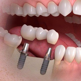 Clínica dental.