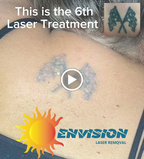 Explore husband name tattoo ideas for wife, creative tattoo ideas in Port Charlotte, available at Envision Laser Removal