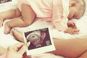 Baby Ultrasound Clinic Prestatyn North Wales image