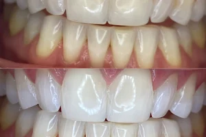 We Whiten Teeth Whitening image