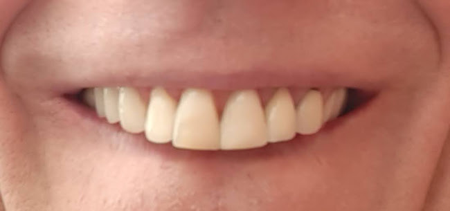 Reviews of Carlton Dental Care in Nottingham - Dentist