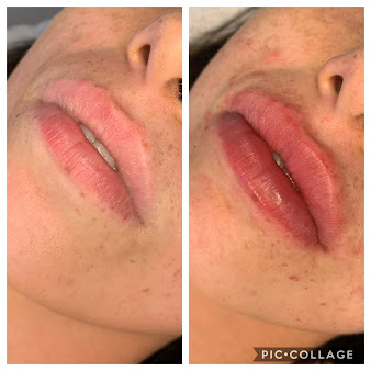 Enhance Aesthetics - Enhance Aesthetics