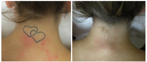 Explore tattoo ideas on leg for men, creative tattoo ideas in Saint Paul, available at Removery Tattoo Removal & Fading