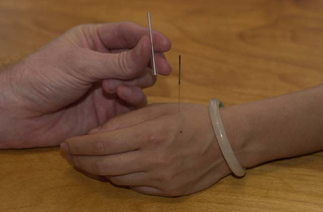 Acupuncture Excellence